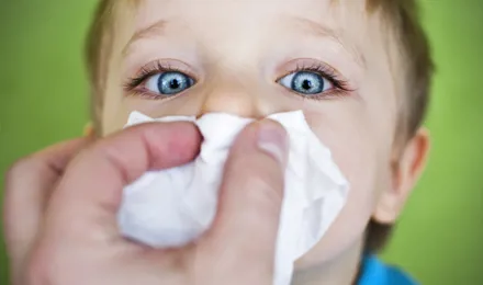 Nosebleeds Causes: Why They Happen and How to Prevent Them